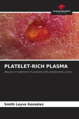 Книга PLATELET-RICH PLASMA 