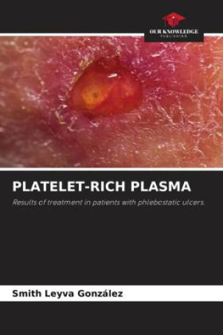 Książka PLATELET-RICH PLASMA 