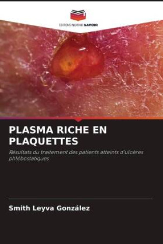 Knjiga PLASMA RICHE EN PLAQUETTES Smith Leyva González