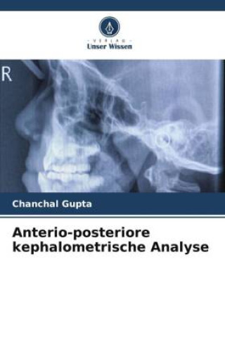 Carte Anterio-posteriore kephalometrische Analyse 