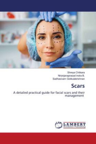 Knjiga Scars Shreya Chitkara