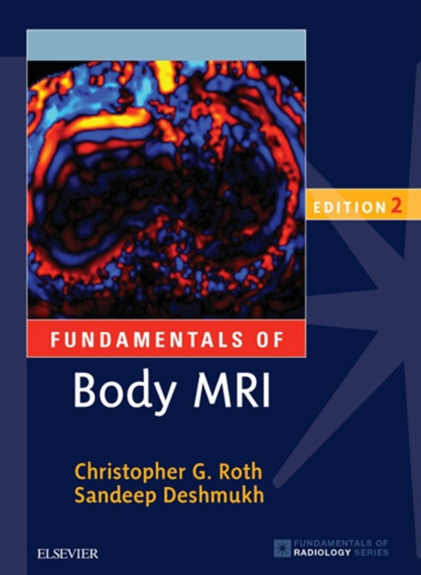 E-kniha Fundamentals of Body MRI E-Book Christopher G. Roth