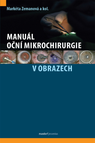 Kniha Manuál oční mikrochirurgie v obrazech Markéta Zemanová