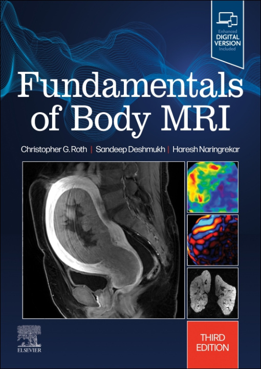 Könyv Fundamentals of Body MRI Christopher G. Roth