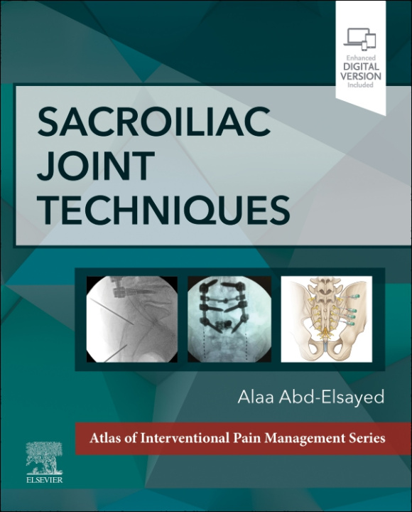 Kniha Sacroiliac Joint Techniques Alaa Abd-Elsayed