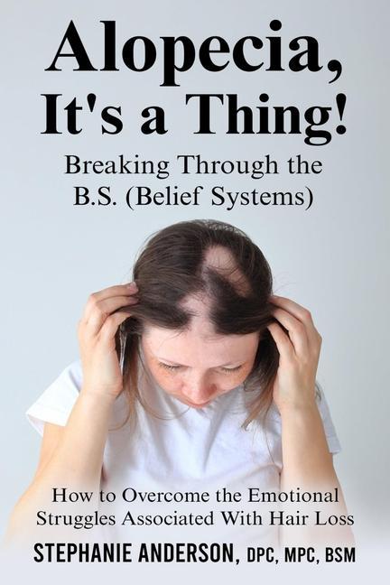 Carte Alopecia, It's a Thing! Breaking Through the B.S. (Belief Systems) Marcel A. Anderson