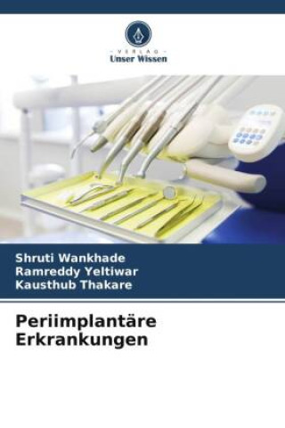 Buch Periimplantäre Erkrankungen Shruti Wankhade
