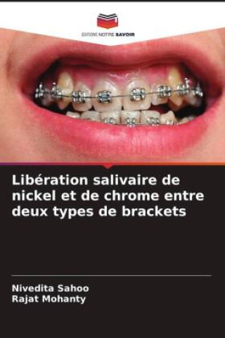 Kniha Libération salivaire de nickel et de chrome entre deux types de brackets Nivedita Sahoo