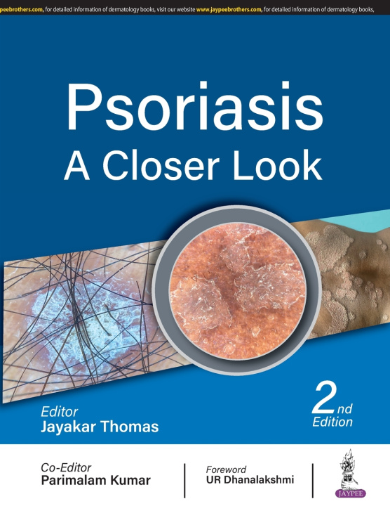 Libro Psoriasis Jayakar Thomas