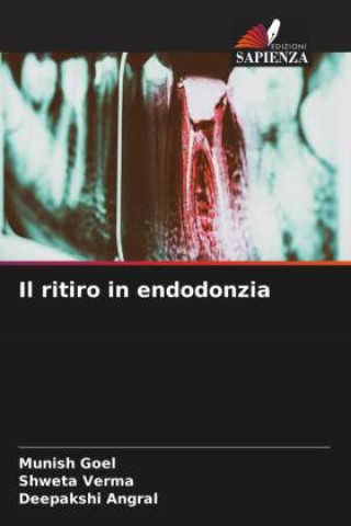 Knjiga Il ritiro in endodonzia Shweta Verma