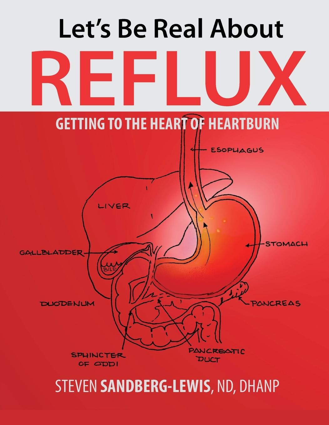 Könyv Let's Be Real About Reflux, Getting To The Heart of Heartburn 