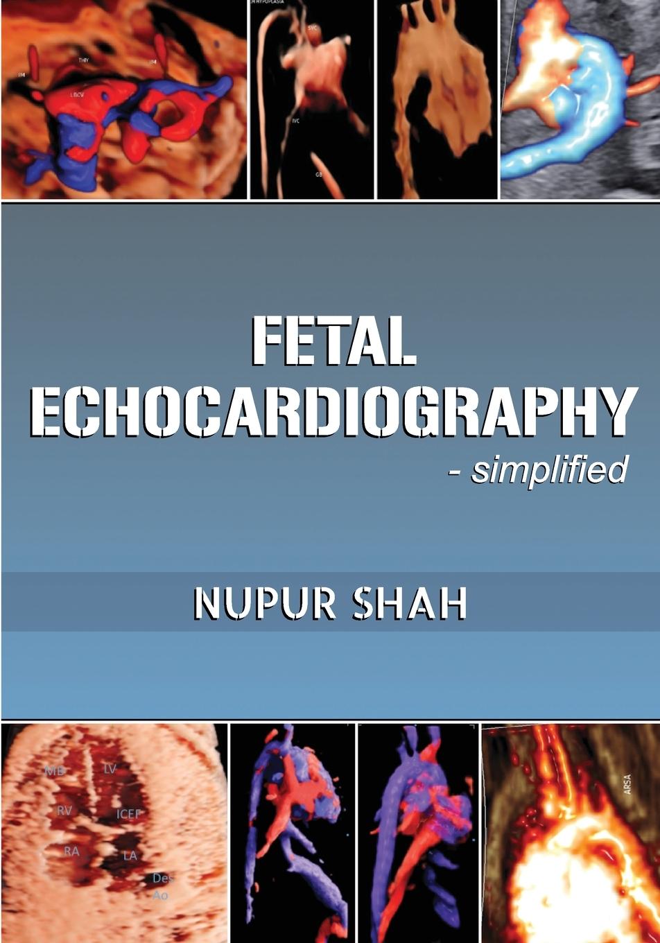 Könyv Fetal Echocardiography - Simplified 