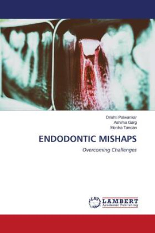 Knjiga ENDODONTIC MISHAPS Ashima Garg