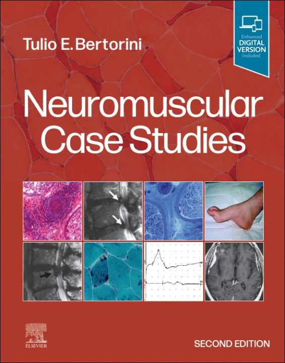 Kniha Neuromuscular Case Studies Tulio E. Bertorini