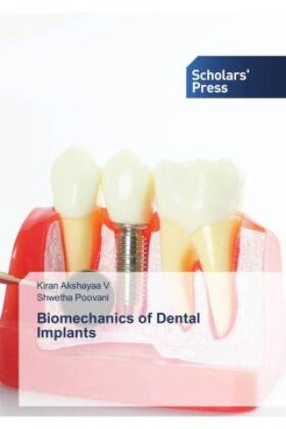 Książka Biomechanics of Dental Implants Shwetha Poovani