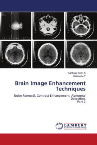 Knjiga Brain Image Enhancement Techniques Kalaiselvi T