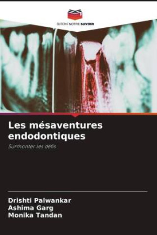 Knjiga Les mésaventures endodontiques Ashima Garg