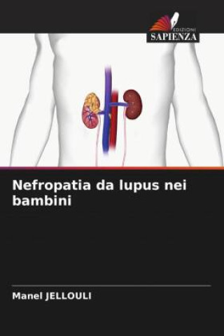 Knjiga Nefropatia da lupus nei bambini Manel Jellouli