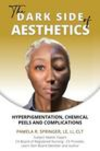 Книга The Dark Side of Aesthetics: Hyperpigmentation, Chemical Peels, and Complications Pamela R Springer