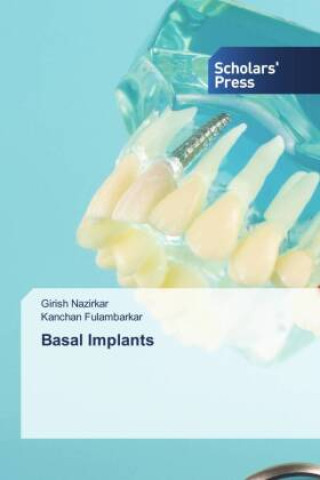 Knjiga Basal Implants Kanchan Fulambarkar