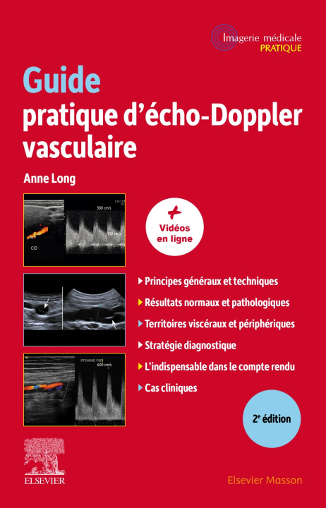 Carte Guide pratique d'écho-Doppler vasculaire Anne Long