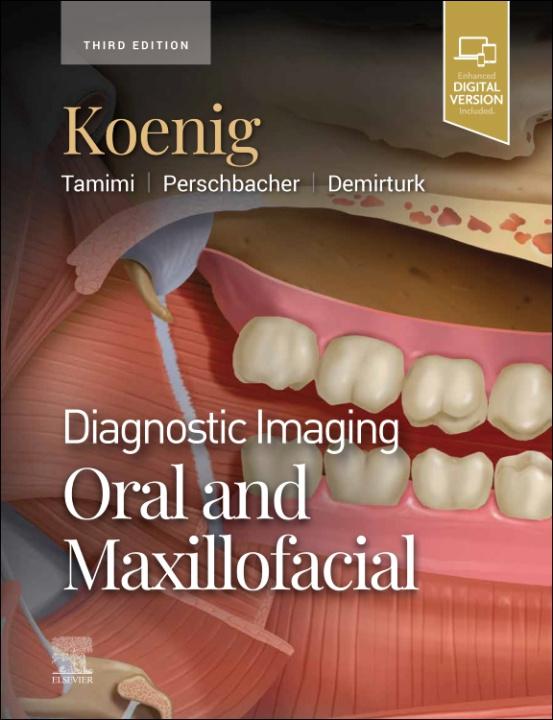 Книга Diagnostic Imaging: Oral and Maxillofacial Lisa J. Koenig