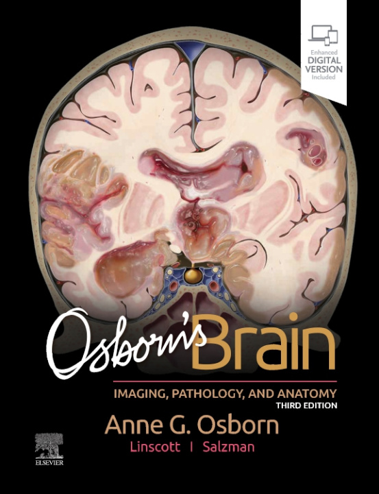 Kniha Osborn's Brain Anne G. Osborn