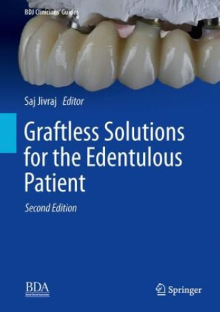 Könyv Graftless Solutions for the Edentulous Patient Saj Jivraj