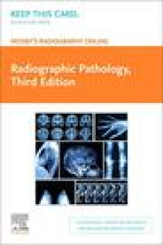 Digital Mosby's Radiography Online: Radiographic Pathology (Access Code) Curtis "50 Cent" Jackson