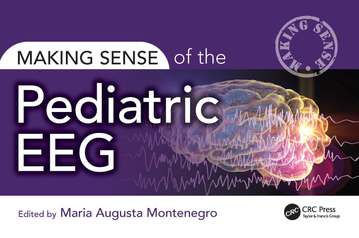 Knjiga Making Sense of the Pediatric EEG 