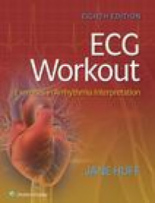 Knjiga ECG Workout: Exercises in Arrhythmia Interpretation HUFF