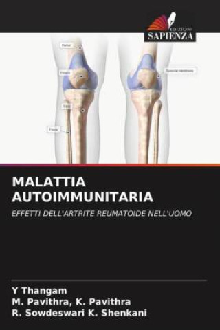 Knjiga MALATTIA AUTOIMMUNITARIA M. Pavithra K. Pavithra