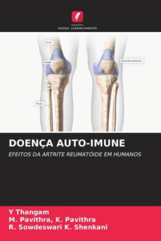 Knjiga DOENÇA AUTO-IMUNE M. Pavithra K. Pavithra