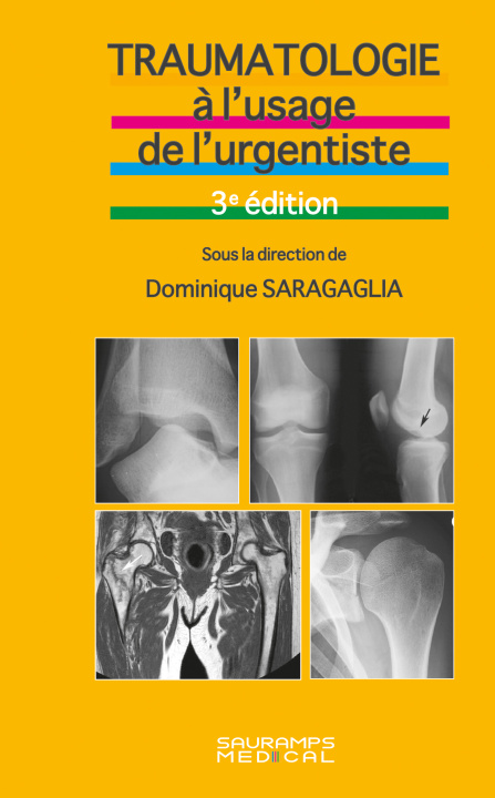 Kniha Traumatologie à l'usage de l'urgentiste. 3ème édition Saragaglia