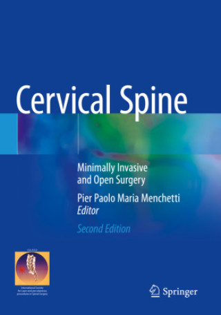 Книга Cervical Spine Pier Paolo Maria Menchetti