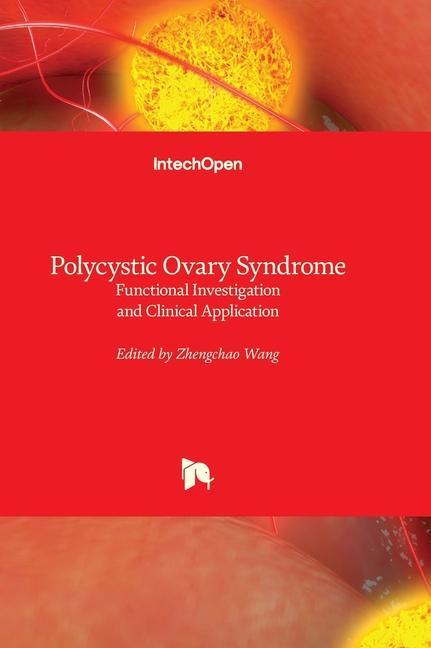 Carte Polycystic Ovary Syndrome - Functional Investigation and Clinical Application 