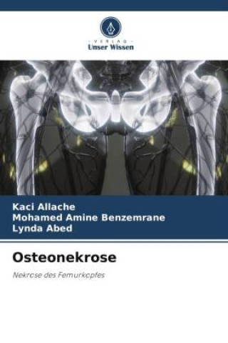 Knjiga Osteonekrose Mohamed Amine Benzemrane