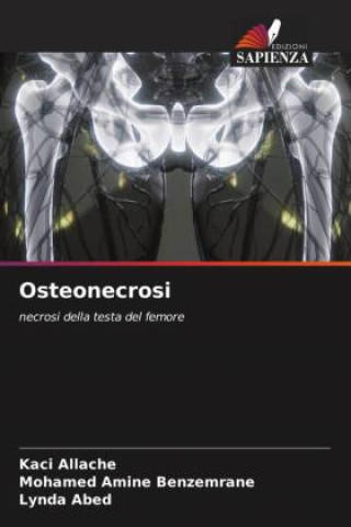 Knjiga Osteonecrosi Mohamed Amine Benzemrane