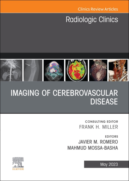 Boek Imaging of Cerebrovascular Disease, An Issue of Radiologic Clinics of North America Javier M. Romero