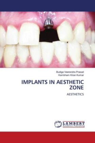 Knjiga IMPLANTS IN AESTHETIC ZONE Kambham Kiran Kumar