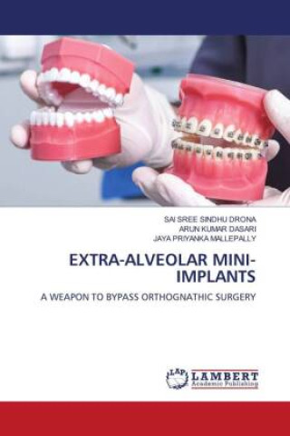 Buch EXTRA-ALVEOLAR MINI-IMPLANTS Arun Kumar Dasari