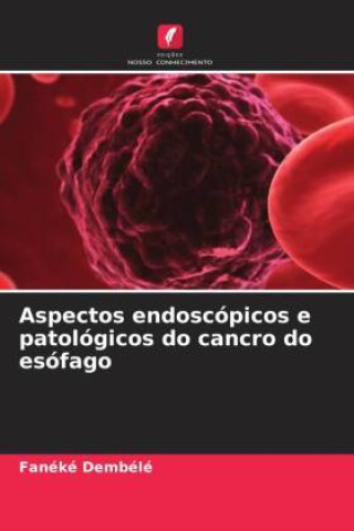 Knjiga Aspectos endoscópicos e patológicos do cancro do esófago Fanéké Dembélé