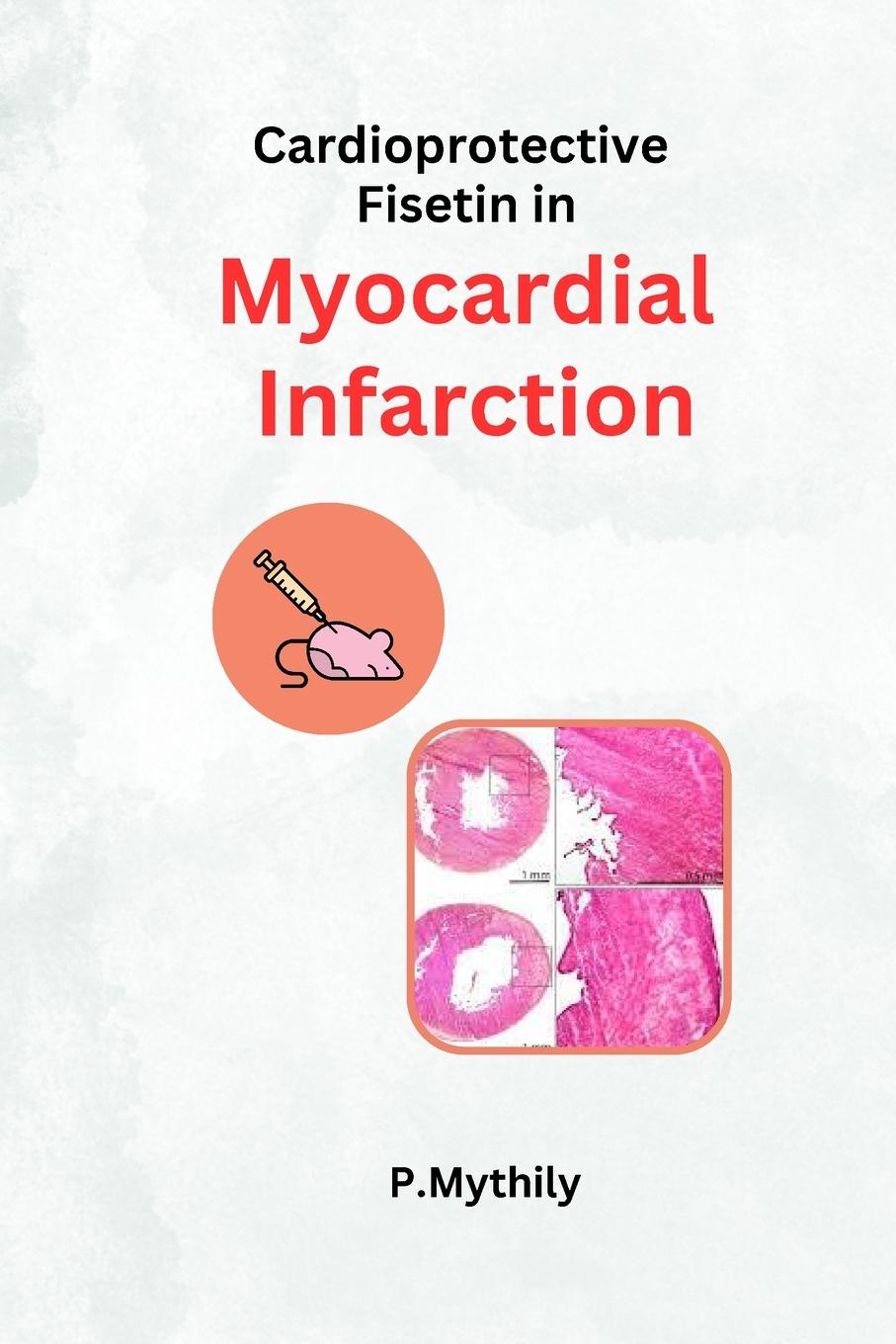 Könyv Cardioprotective Fisetin in Myocardial Infarction 