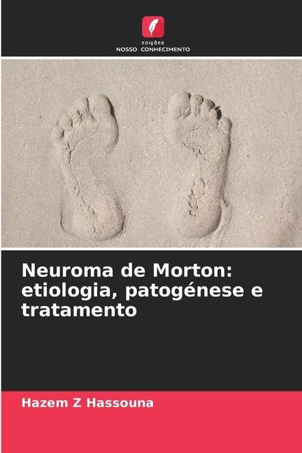 Buch Neuroma de Morton: etiologia, patogénese e tratamento Hazem Z Hassouna