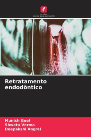 Libro Retratamento endodôntico Shweta Verma
