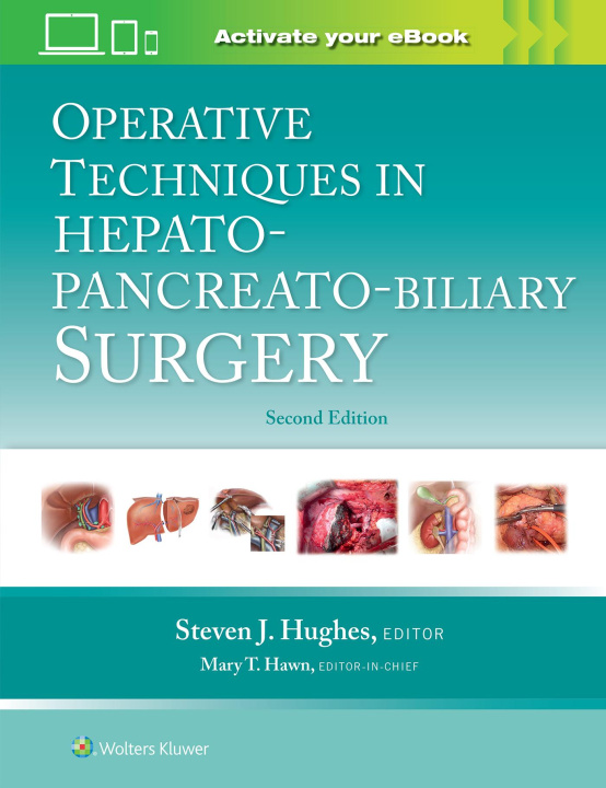 Book Operative Techniques in Hepato-Pancreato-Biliary Surgery 