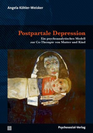 Könyv Postpartale Depression Angela Köhler-Weisker