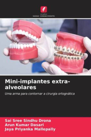 Knjiga Mini-implantes extra-alveolares Arun Kumar Dasari