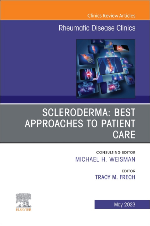 Buch Scleroderma: Best Approaches to Patient Care, An Issue of Rheumatic Disease Clinics of North America Tracy M. Frech