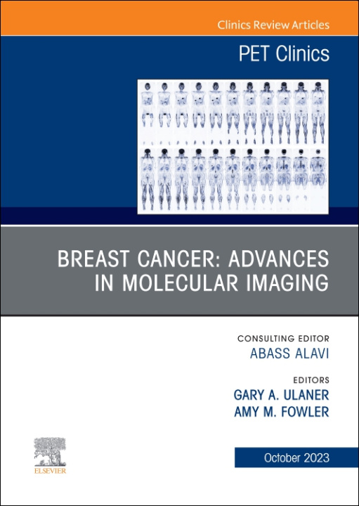 Книга Breast Cancer: Advances in Molecular Imaging, An Issue of PET Clinics Gary A. Ulaner